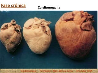 Fase crônica
Epidemiologia Professor: Msc. Márcio Silva Itaituba 2014
Cardiomegalia
 