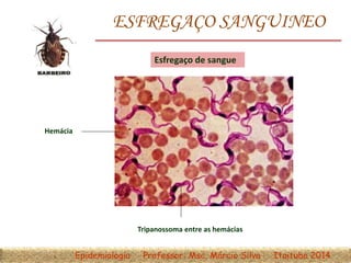 ESFREGAÇO SANGUINEO
Esfregaço de sangue
Hemácia
Tripanossoma entre as hemácias
Epidemiologia Professor: Msc. Márcio Silva Itaituba 2014
 