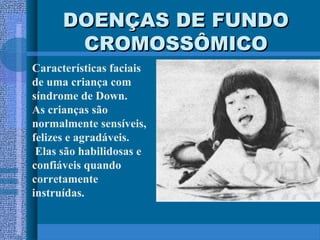 DOENÇAS DE FUNDODOENÇAS DE FUNDO
CROMOSSÔMICOCROMOSSÔMICO
Características faciais
de uma criança com
síndrome de Down.
As crianças são
normalmente sensíveis,
felizes e agradáveis.
Elas são habilidosas e
confiáveis quando
corretamente
instruídas.
 