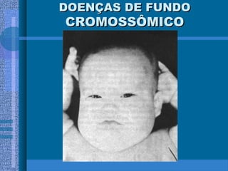 DOENÇAS DE FUNDODOENÇAS DE FUNDO
CROMOSSÔMICOCROMOSSÔMICO
 