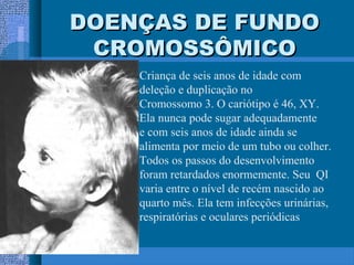 DOENÇAS DE FUNDODOENÇAS DE FUNDO
CROMOSSÔMICOCROMOSSÔMICO
Criança de seis anos de idade com
deleção e duplicação no
Cromossomo 3. O cariótipo é 46, XY.
Ela nunca pode sugar adequadamente
e com seis anos de idade ainda se
alimenta por meio de um tubo ou colher.
Todos os passos do desenvolvimento
foram retardados enormemente. Seu QI
varia entre o nível de recém nascido ao
quarto mês. Ela tem infecções urinárias,
respiratórias e oculares periódicas
 
