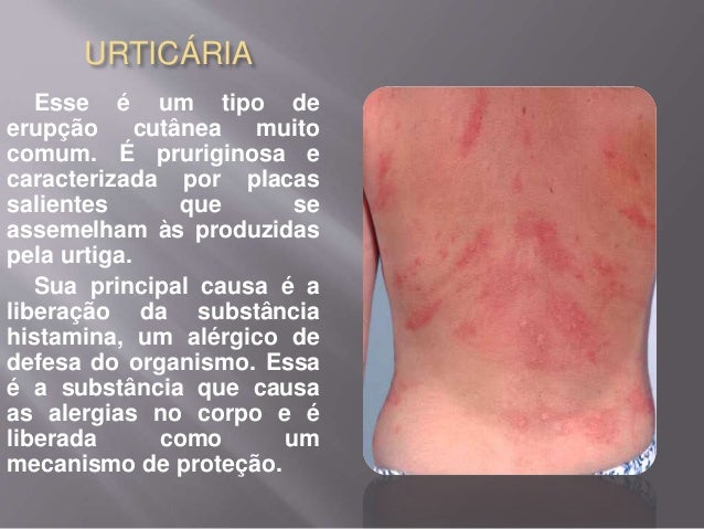 Doenças A a Z | Atlas da Saúde