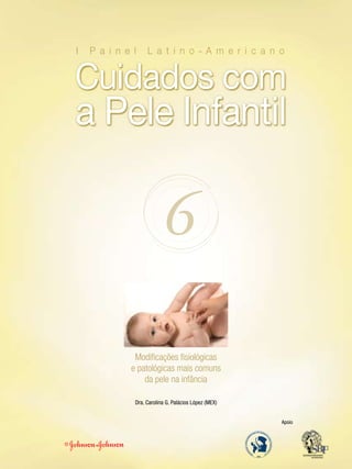 6
Modificações fisiológicas
e patológicas mais comuns
da pele na infância
Dra. Carolina G. Palácios López (MEX)
Apoio
 
