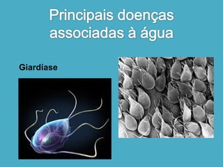 Giardíase 
 