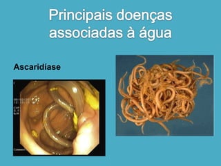 Ascaridíase 
 