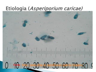  Apresenta estroma subpidérmico.
 60 x 200 mm e 60-80 mm de altura, produzindo
conidióforos fasciculados, eretos e septados.
 Os conídios são piriformes ou oblongos com
dimensões de 10-24 x 8-10 mm,
escuros,equinulados e bicelulares.
 Disseminação:vento, respingo de chuvas, orvalho.
Fonte : http://www.ufrgs.br/agrofitossan/galeria/imagens/
 