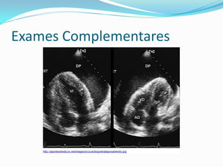 Exames Complementares
 