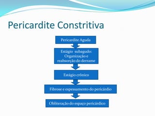 Pericardite Constritiva
               Pericardite Aguda

               Estágio subagudo:
                 Organização e
             reabsorção do derrame


                 Estágio crônico


         Fibrose e espessamento do pericárdio


         Obliteração do espaço pericárdico
 