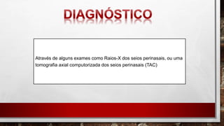 Através de alguns exames como Raios-X dos seios perinasais, ou uma
tomografia axial computorizada dos seios perinasais (TAC)
 