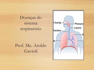 Doenças do
sistema
respiratório
Prof. Me. Aroldo
Gavioli
 