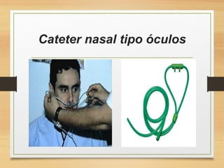Cateter nasal tipo óculos
 