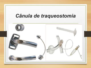 Cânula de traqueostomia
 