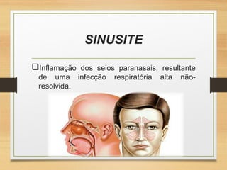 SINUSITE
Inflamação dos seios paranasais, resultante
de uma infecção respiratória alta não-
resolvida.
 