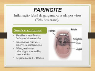 FARINGITE
Inflamação febril da garganta causada por vírus
(70% dos casos).
 