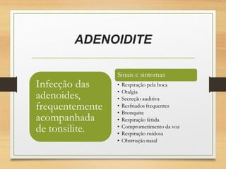 ADENOIDITE
 