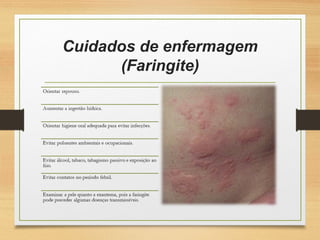 Cuidados de enfermagem
(Faringite)
 