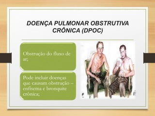 DOENÇA PULMONAR OBSTRUTIVA
CRÔNICA (DPOC)
 