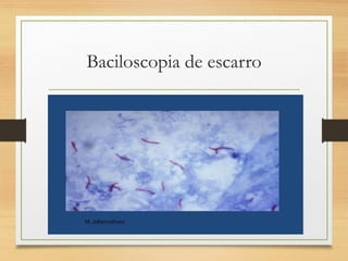 Baciloscopia de escarro
 