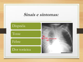Sinais e sintomas:
 