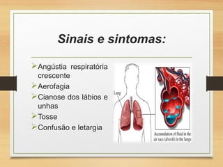 Sinais e sintomas:
Angústia respiratória
crescente
Aerofagia
Cianose dos lábios e
unhas
Tosse
Confusão e letargia
 