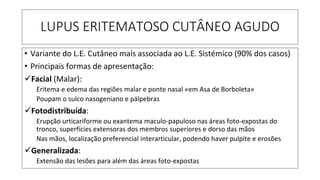 LUPUS ERITEMATOSO CUTÂNEO AGUDO
• Variante do L.E. Cutâneo mais associada ao L.E. Sistémico (90% dos casos)
• Principais formas de apresentação:
✓Facial (Malar):
Eritema e edema das regiões malar e ponte nasal «em Asa de Borboleta»
Poupam o sulco nasogeniano e pálpebras
✓Fotodistribuída:
Erupção urticariforme ou exantema maculo-papuloso nas áreas foto-expostas do
tronco, superfícies extensoras dos membros superiores e dorso das mãos
Nas mãos, localização preferencial interarticular, podendo haver pulpite e erosões
✓Generalizada:
Extensão das lesões para além das áreas foto-expostas
 