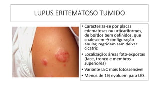 LUPUS ERITEMATOSO TUMIDO
• Caracteriza-se por placas
edematosas ou urticariformes,
de bordos bem definidos, que
coalescem →configuração
anular, regridem sem deixar
cicatriz
• Localização: áreas foto-expostas
(face, tronco e membros
superiores)
• Variante LEC mais fotossensível
• Menos de 1% evoluem para LES
 