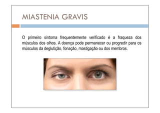 MIASTENIA GRAVIS

O primeiro sintoma frequentemente verificado é a fraqueza dos
músculos dos olhos. A doença pode permanecer ou progredir para os
músculos da deglutição, fonação, mastigação ou dos membros.
 