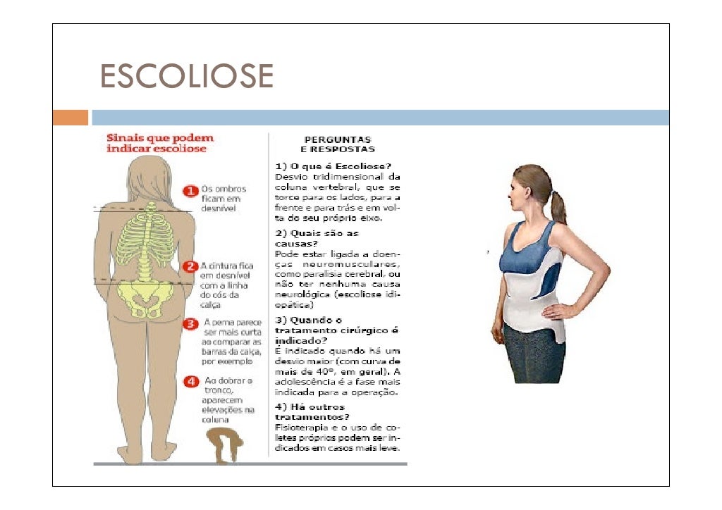 Doenças Do Sistema Esquelético - RETOEDU