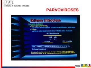 PARVOVIROSES 