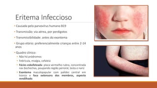 Eritema Infeccioso
• Causada pelo parvovírus humano B19
• Transmissão: via aérea, por perdigotos
• Transmissibilidade: antes do exantema
• Grupo etário: preferencialmente crianças entre 2-14
anos
• Quadro clínico:
• Não há pródromos
• Febrícula, mialgia, cefaleia
• Fácies esbofeteada: placa vermelho rubra, concentrada
nas bochechas, poupando região perioral, testa e nariz
• Exantema maculopapular com palidez central em
tronco e face extensora dos membros, aspecto
rendilhado
 