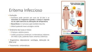 Eritema Infeccioso
• Evolução:
• Exantema pode persistir por mais de 10 dias e se
exacerbar ou reaparecer quando a criança é exposta
ao sol, após exercício ou alterações de temperatura
• Recorrência 1-2 semanas após também descrita
• Afebril podendo haver artralgia e artrite
• Síndrome das luvas e meias:
• Crianças e adultos jovens
• Lesões purpúricas simétricas e eritematosas indolores
em mãos e pés, podendo haver sintomas sistêmicos
• Diagnóstico laboratorial: sorologia, detecção de
DNA viral
• Tratamento: sintomáticos
 