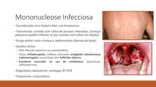 Mononucleose Infecciosa
• Causada pelo vírus Epstein-Barr, um herpesvírus
• Transmissão: contato com saliva de pessoas infectadas. Crianças
pequenas podem infectar-se por contato com saliva em objetos
• Grupo etário: mais crianças e adolescentes (doença do beijo)
• Quadro clínico:
• 50% infecção subclínica ou assintomática
• Febre, linfadenopatia, cefaleia, mal-estar, amigdalite membranosa,
esplenomegalia. Leucocitose com linfócitos atípicos
• Exantema associado ao uso de antibióticos (penicilinas,
cefalosporinas)
• Diagnóstico laboratorial: sorologia, RT-PCR
• Tratamento: sintomáticos
 