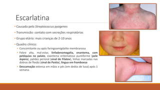Escarlatina
• Causada pelo Streptococcus pyogenes
• Transmissão: contato com secreções respiratórias
• Grupo etário: mais crianças de 2-10 anos
• Quadro clínico:
• Concomitante ou após faringoamigdalite membranosa
• Febre alta, mal-estar, linfadenomegalia, enantema, com
petéquias no palato, exantema eritematoso puntiforme (pele
áspera), palidez perioral (sinal de Filatov), linhas marcadas nas
dobras de flexão (sinal de Pastia), língua em framboesa
• Descamação extensa em mãos e pés (em dedos de luva) após 1
semana.
 
