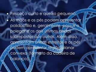  Pescoço curto e queixo pequeno;
 As mãos e os pés podem apresentar
polidactilia e, geralmente, possuir o
polegar e os dois últimos dedos
sobrepostos aos outros. Além disso,
apresentam unhas estreitas e os pés
podem apresentar região planar
convexa (formato da cadeira de
balanço);
 