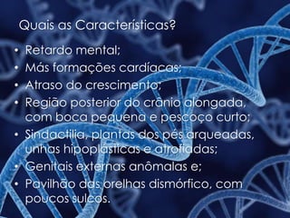 Quais as Características?
• Retardo mental;
• Más formações cardíacas;
• Atraso do crescimento;
• Região posterior do crânio alongada,
com boca pequena e pescoço curto;
• Sindactilia, plantas dos pés arqueadas,
unhas hipoplásticas e atrofiadas;
• Genitais externas anômalas e;
• Pavilhão das orelhas dismórfico, com
poucos sulcos.
 