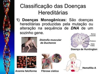 Classificação das Doenças Hereditárias 1) Doenças Monogênicas:  São doenças hereditárias produzidas pela mutação ou alteração na sequência de  DNA  de um sozinho gene.   Anemia falciforme Fibrose cística Doença de Huntington   Distrofia muscular de Duchenne Hemofilia A 