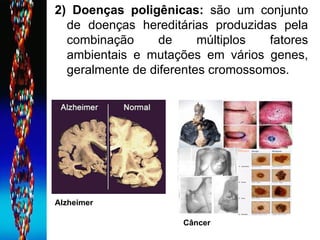 2) Doenças poligênicas:  são um conjunto de doenças hereditárias produzidas pela combinação de múltiplos fatores ambientais e mutações em vários genes, geralmente de diferentes cromossomos. Alzheimer Câncer 