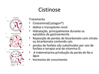 Cistinose
Tratamento
• Cisteamina(Cystagon®)
• diálise e transplante renal
• Hidratação, principalmente durante os
episódios de gastroenterite
• Reposição de perdas de bicarbonato com citrato
ou bicarbonato contendo sais
• perdas de fosfato são substituídos por sais de
fosfato e terapia oral de vitamina D.
• A indometacina p/redução da perda de Na e
água
• hormonio de crescimento
 