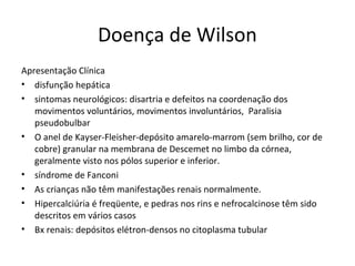 Doença de Wilson
Apresentação Clínica
• disfunção hepática
• sintomas neurológicos: disartria e defeitos na coordenação dos
movimentos voluntários, movimentos involuntários, Paralisia
pseudobulbar
• O anel de Kayser-Fleisher-depósito amarelo-marrom (sem brilho, cor de
cobre) granular na membrana de Descemet no limbo da córnea,
geralmente visto nos pólos superior e inferior.
• síndrome de Fanconi
• As crianças não têm manifestações renais normalmente.
• Hipercalciúria é freqüente, e pedras nos rins e nefrocalcinose têm sido
descritos em vários casos
• Bx renais: depósitos elétron-densos no citoplasma tubular
 