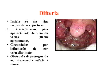 Difteria
• Instala se nas vias
respiratórias superiores
• Caracteriza-se pelo
aparecimento de uma ou
várias placas
acinzentadas,
• Circundadas por
inflamação de cor
vermelho-mate,
• Obstrução da passagem do
ar, provocando asfixia e
morte
 