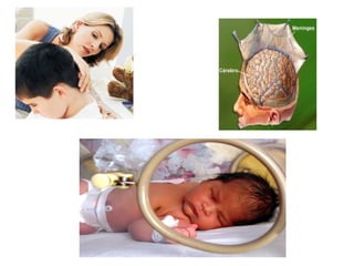 Doenças Imunopreveníveis na Infância e Imunização.ppt