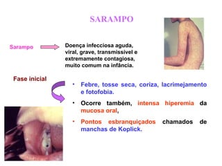 SARAMPO
Sarampo Doença infecciosa aguda,
viral, grave, transmissível e
extremamente contagiosa,
muito comum na infância.
Fase inicial
• Febre, tosse seca, coriza, lacrimejamento
e fotofobia.
• Ocorre também, intensa hiperemia da
mucosa oral,
• Pontos esbranquiçados chamados de
manchas de Koplick.
 