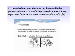  transmissão oral-oral ocorre por intermédio das
gotículas de muco da orofaringe quando a pessoa tosse,
espirra ou fala ( uma a duas semanas após a infecção).
 