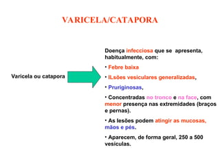 VARICELA/CATAPORA
Varicela ou catapora
Doença infecciosa que se apresenta,
habitualmente, com:
• Febre baixa
• lLsões vesiculares generalizadas,
• Pruriginosas,
• Concentradas no tronco e na face, com
menor presença nas extremidades (braços
e pernas).
• As lesões podem atingir as mucosas,
mãos e pés.
• Aparecem, de forma geral, 250 a 500
vesículas.
 