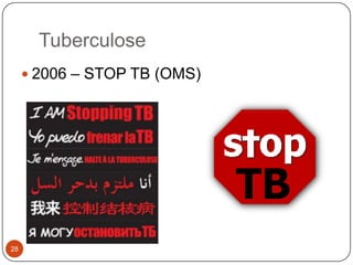 Tuberculose
      2006 – STOP TB (OMS)




28
 