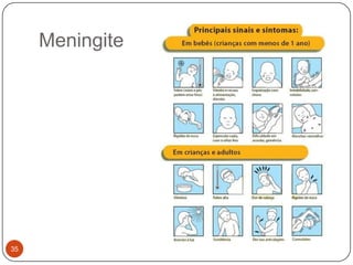 Meningite




35
 