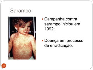 Sarampo
                Campanha contra
                sarampo iniciou em
                1992;

                Doença em processo
                de erradicação.



59
 