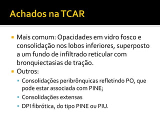    Mais comum: Opacidades em vidro fosco e
    consolidação nos lobos inferiores, superposto
    a um fundo de infiltrado reticular com
    bronquiectasias de tração.
   Outros:
     Consolidações peribrônquicas refletindo PO, que
      pode estar associada com PINE;
     Consolidações extensas
     DPI fibrótica, do tipo PINE ou PIU.
 
