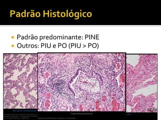    Padrão predominante: PINE
   Outros: PIU e PO (PIU > PO)
 