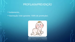 PROFILAXIA/PREVENÇÃO
• Isolamento,
• Vacinação (não garante 100% de proteção);
 